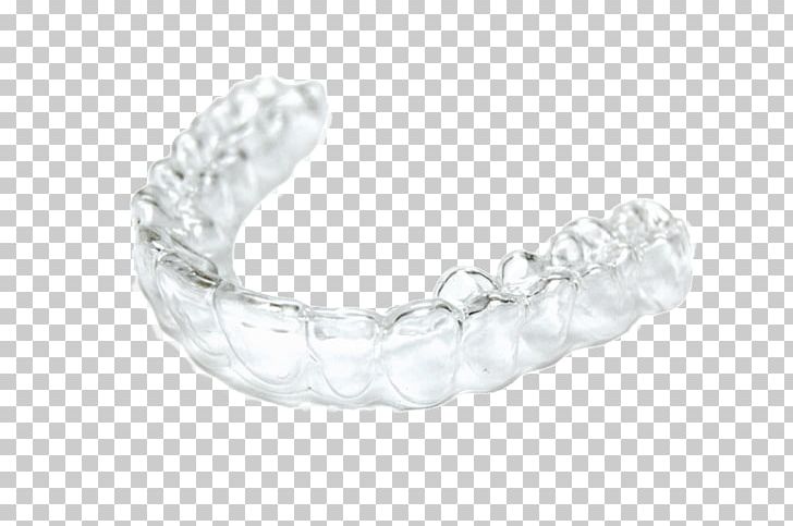 Clear Aligners Dental Braces Orthodontics Dentistry Retainer PNG, Clipart, Body Jewelry, Bracelet, Bridge, Clear Aligners, Clearcorrect Free PNG Download