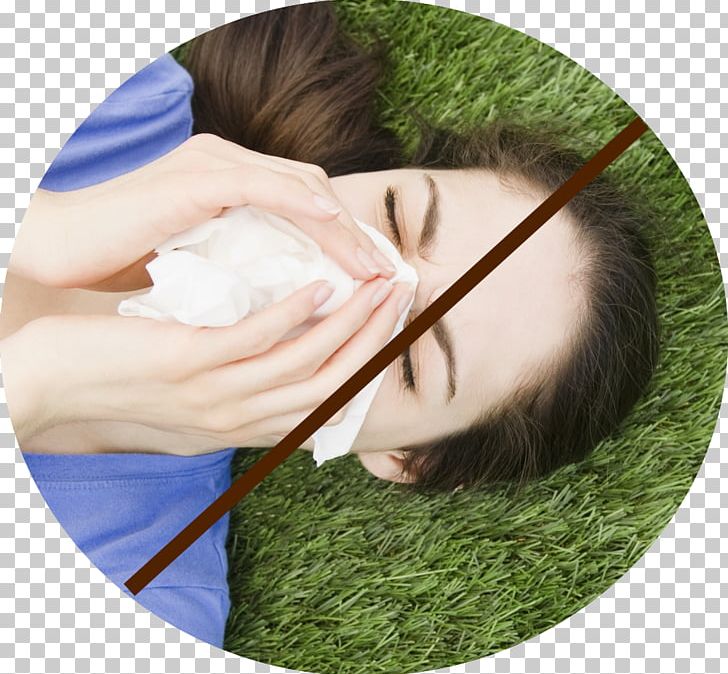 Allergy Hay Fever Therapy Disease Symptom PNG, Clipart, Allergic Rhinitis Due To Pollen, Allergy, Cure, Dermatitis, Disease Free PNG Download