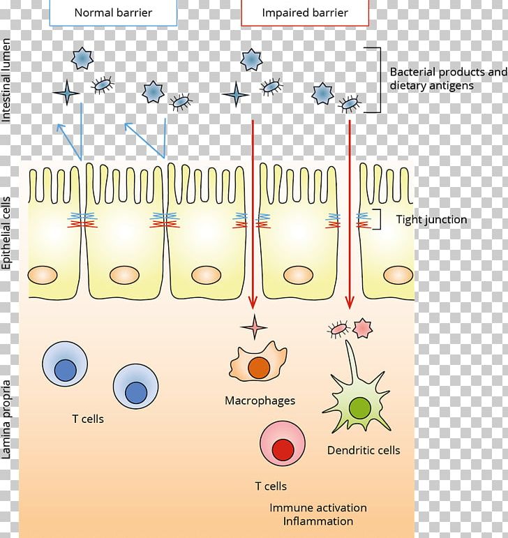 Tight Junction Large Intestine Intestinal Epithelium Intestinal Permeability PNG, Clipart, Autoimmune, Disease, Intestinal Epithelium, Intestinal Permeability, Large Intestine Free PNG Download