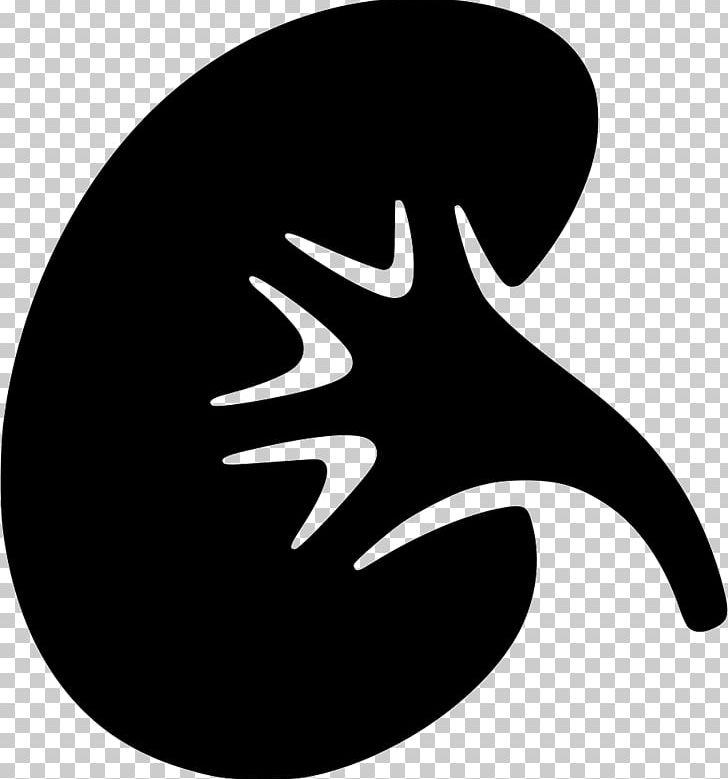Chronic Kidney Disease Cancer And The Kidney Kidney Failure PNG, Clipart, Acute Kidney Failure, Black And White, Cancer, Cdr, Chronic Kidney Disease Free PNG Download