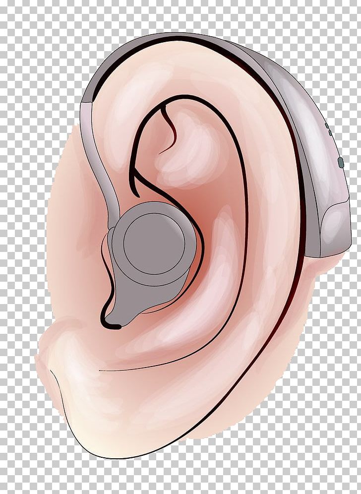 Hearing Aid Hearing Loss PNG, Clipart, Abayizithulu, Auricle, Cartoon, Cat Ear, Cheek Free PNG Download