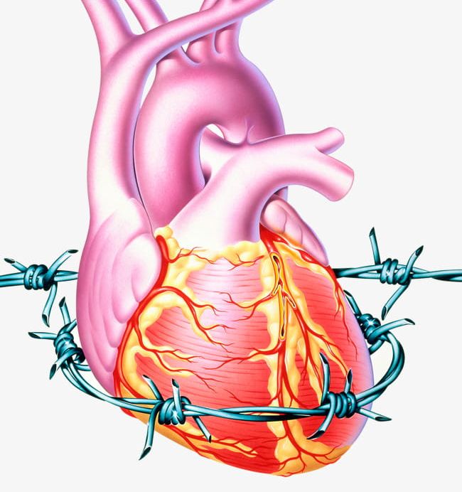 Cholesterol Coronary Heart Disease PNG, Clipart, Blood, Blood Vessels, Cholesterol, Coronary, Coronary Heart Disease Free PNG Download