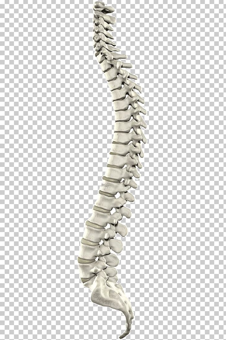 Myelography Spinal Cord Vertebral Column Spinal Canal Computed Tomography PNG, Clipart, Central Nervous System, Cervical Vertebrae, Computed Tomography, Laminectomy, Magnetic Resonance Imaging Free PNG Download