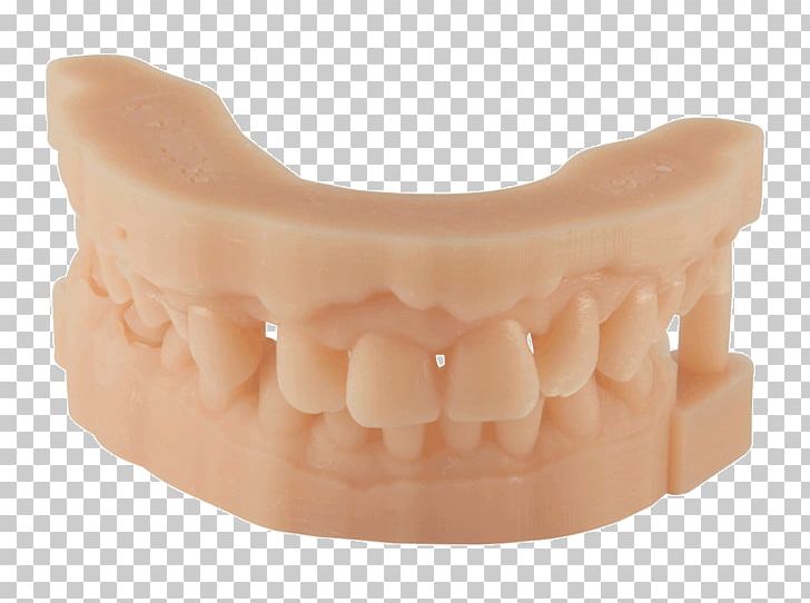 3D Printing Resin Dentistry Tooth PNG, Clipart, 3d Printing, Acrylonitrile Butadiene Styrene, Activity, Dental Composite, Dentistry Free PNG Download