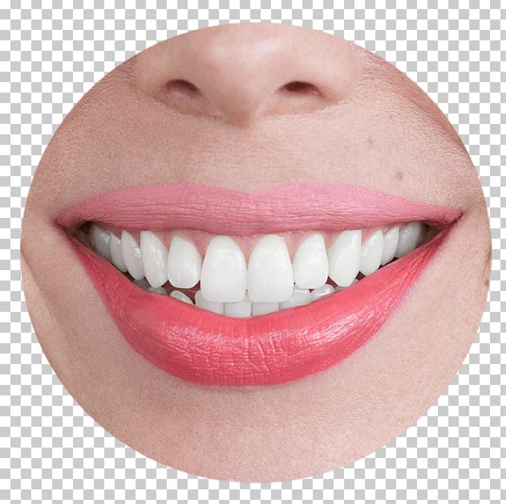 Smile Lip Trick Ulta Beauty Urban Decay PNG, Clipart, Chin, Closeup, Closeup, Cosmetic Dentistry, Facial Expression Free PNG Download