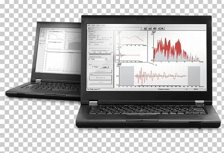 Otoacoustic Emission System Information Computer Software Digital Data PNG, Clipart, Auditory Brainstem Response, Brand, Computer, Computer Hardware, Computer Monitor Accessory Free PNG Download