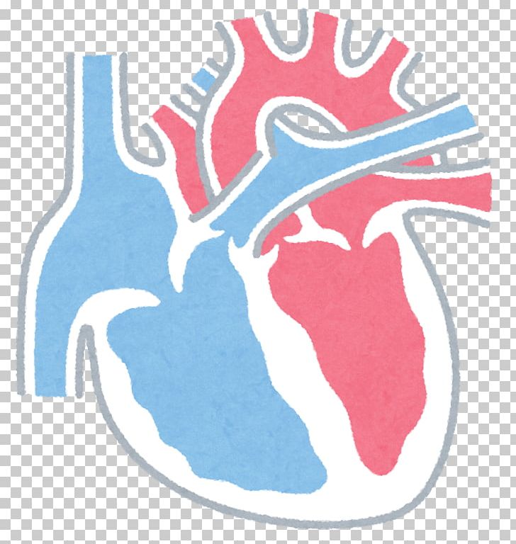 Coronary Artery Disease Heart Premature Ventricular Contraction Cardiology PNG, Clipart,  Free PNG Download