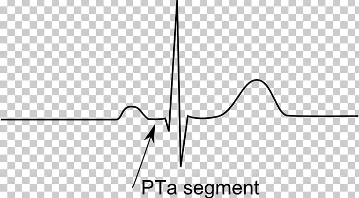 Passenger Terminal Amsterdam Doctor Of Medicine Doctor Of Philosophy PNG, Clipart, Acute Myocardial Infarction, Angle, Area, Black, Black And White Free PNG Download