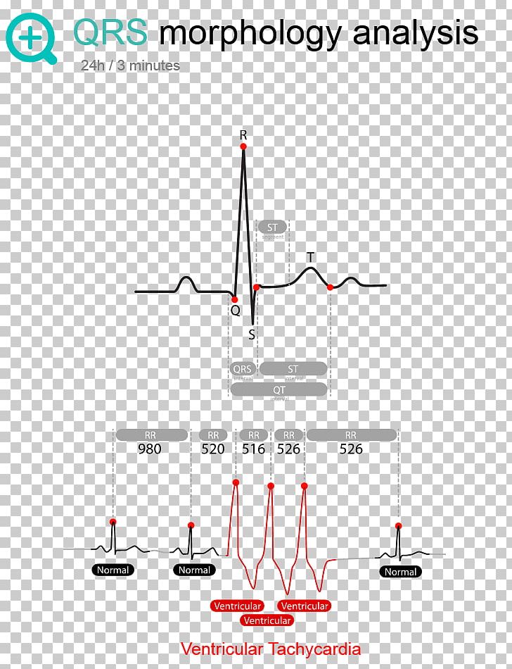 Line Point Angle PNG, Clipart, Angle, Area, Diagram, Ecg Monitor, Line Free PNG Download