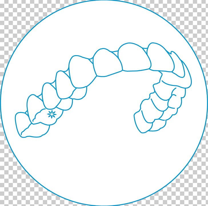 Clear Aligners Orthodontics Retainer Tooth Invisibility PNG, Clipart, Aesthetics, Area, Black And White, Circle, Clear Aligners Free PNG Download