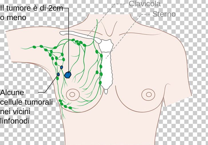 Axilla Lymph Node Arm Diagram PNG, Clipart, Abdomen, Anatomy, Angle, Arm, Axilla Free PNG Download