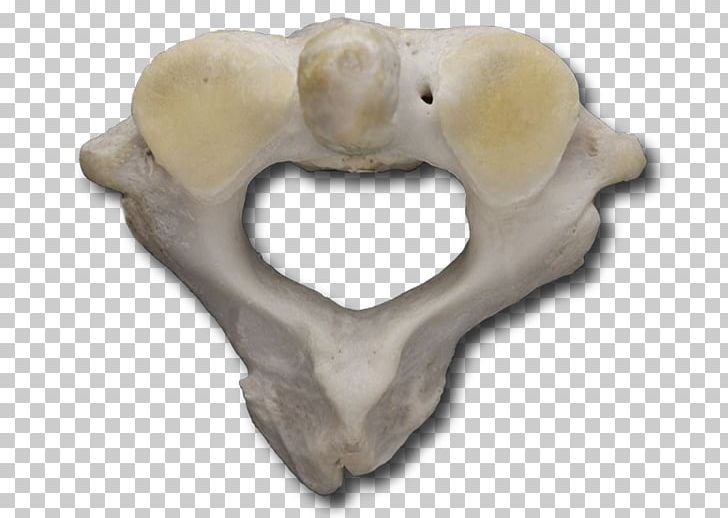 Atlas Anatomy Bone Snout Vertebral Column PNG, Clipart, Anatomy, Atlas, Bone, Head Restraint, Jaw Free PNG Download