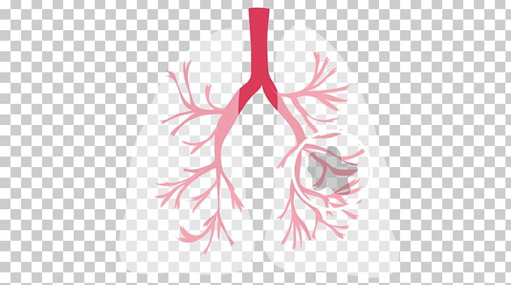 Non-small Cell Lung Cancer Cystic Fibrosis PNG, Clipart, Cancer, Computer Wallpaper, Disease, Flower, Genetic Disorder Free PNG Download