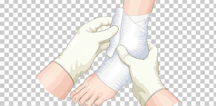 Bandage Sprain Foot Thumb Ankle PNG, Clipart, Ankle, Arm, Bandage, Crus, Finger Free PNG Download