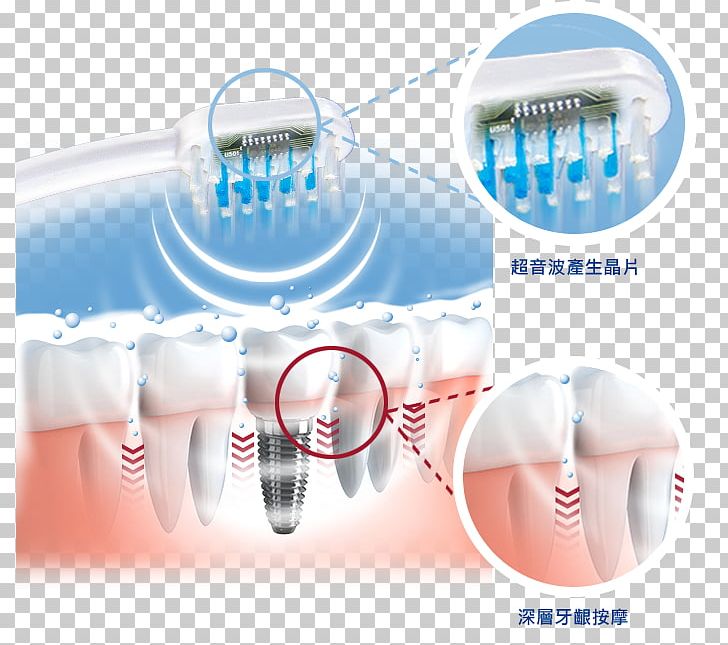 Electric Toothbrush Dentistry Ultrasonic Toothbrush PNG, Clipart,  Free PNG Download