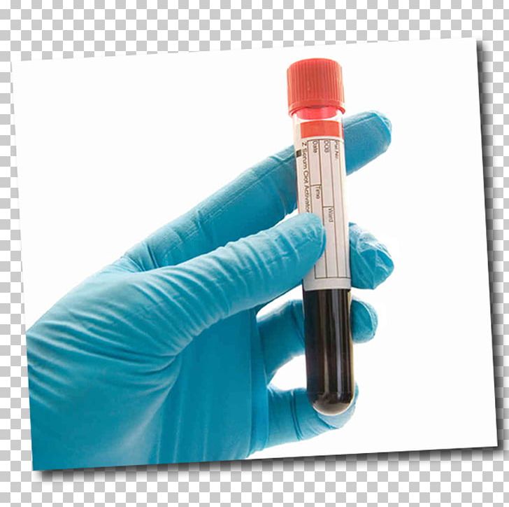 Blood Test Drug Test Herpes Simplex Hepatitis B PNG, Clipart, Alcohol, Blood, Blood Alcohol Content, Blood Donation, Blood Test Free PNG Download