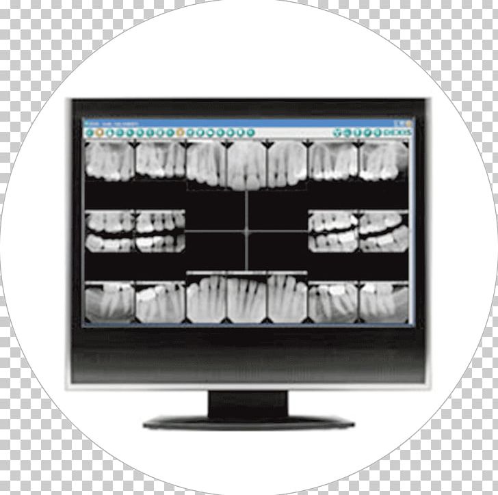 Dentistry Digital Radiography Tooth PNG, Clipart, Dental, Dental Radiography, Dentist, Dentistry, Digital Free PNG Download