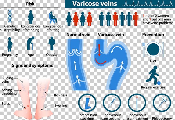 Varicose Veins Telangiectasia Risk Factor Therapy PNG, Clipart, Area, Blue, Brand, Cause, Chronic Venous Insufficiency Free PNG Download