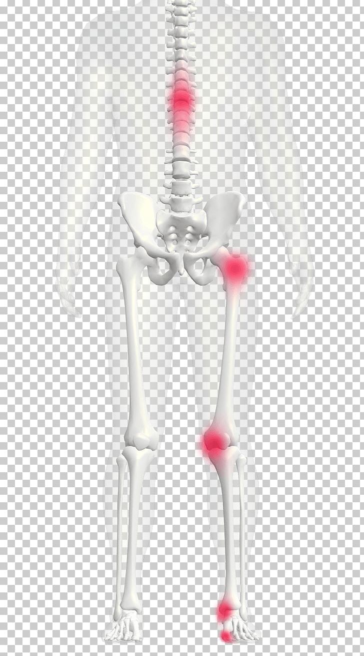 Flat Feet Human Leg Arm Arches Of The Foot PNG, Clipart, Abdomen, Arches Of The Foot, Arm, Back, Chest Free PNG Download