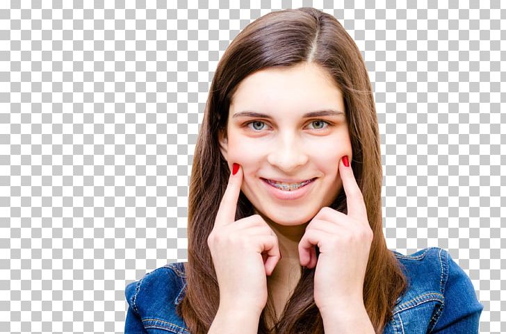 Orthodontics Clinica Dental Virma Clear Aligners Dental Braces Tooth PNG, Clipart, Adolescence, Beauty, Brown Hair, Cheek, Child Free PNG Download