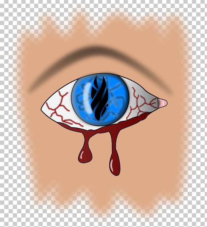Eye Bleeding Drawing Blood PNG, Clipart, Bleeding, Blood, Computer Icons, Drawing, Eye Free PNG Download