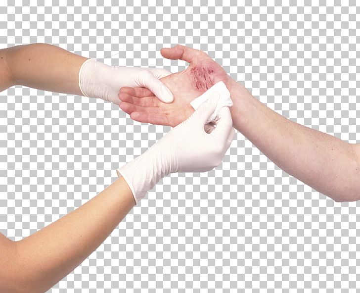 Wound Dressing Arm Bandage Cutting PNG, Clipart, Bleeding, Cleaning, Dust Explosion, Forearm, Garbage Free PNG Download