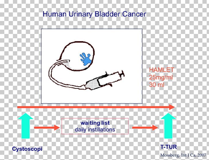 Line Angle Finger PNG, Clipart, Angle, Area, Bladder Cancer, Brand, Cable Free PNG Download