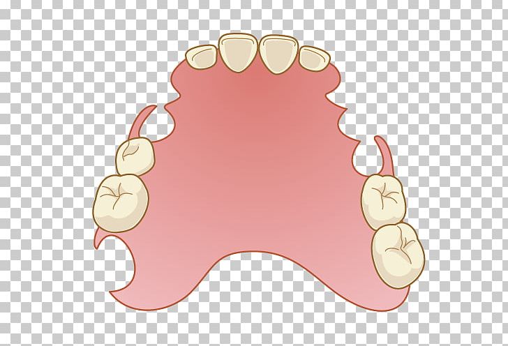 Dentistry Dentures Removable Partial Denture Mouth PNG, Clipart, Bridge, Dentist, Dentistry, Dentures, Finger Free PNG Download