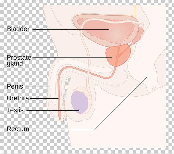 Ear Prostate Cancer Gland Prostatitis PNG, Clipart, Abdomen, Adenocarcinoma, Angle, Arm, Benign Prostatic Hyperplasia Free PNG Download