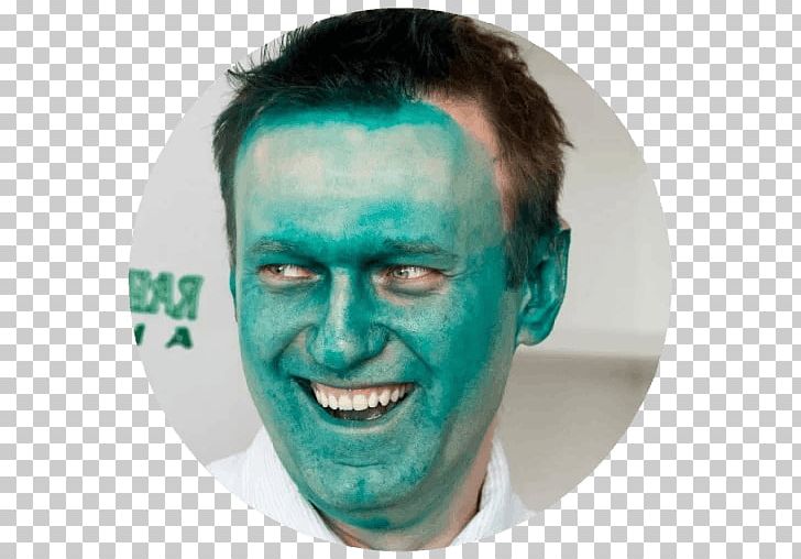 Alexei Navalny Zelyonka Attack Politician Anti-Corruption Foundation Political Campaign Staff PNG, Clipart, Anticorruption Foundation, Arseniy Yatsenyuk, Barnaul, Cheek, Face Free PNG Download