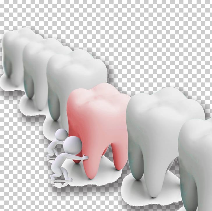 Dental Poster PNG, Clipart, Cars, Cartoon, Creative Posters, Decayed Tooth, Decorative Patterns Free PNG Download