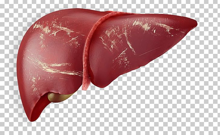 Liver Human Anatomy Human Body Stock Photography PNG, Clipart, Anatomy, Cirrhosis, Gallbladder, Health, Hep Free PNG Download
