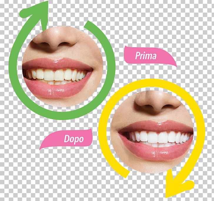 Beard Health Tooth Whitening Dietary Supplement PNG, Clipart, Beard, Capsule, Cheek, Chin, Coal Free PNG Download
