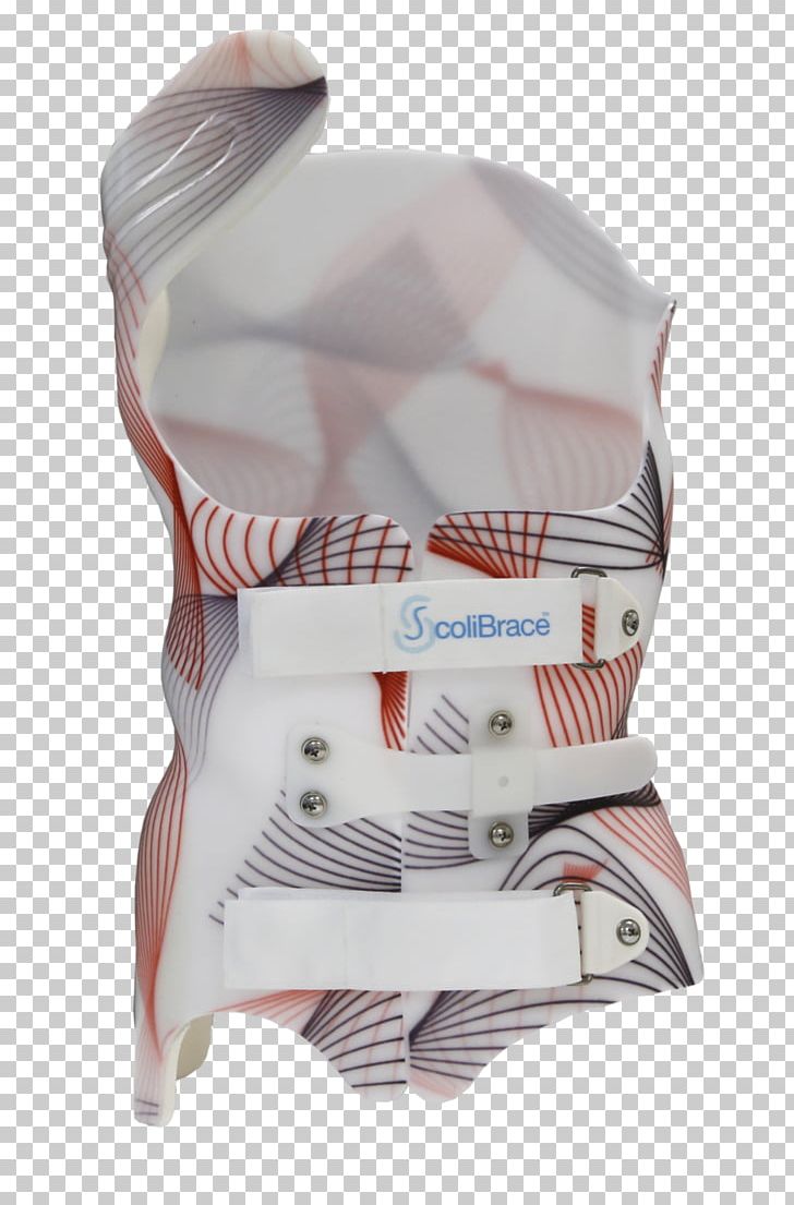 Community Chiropractic Center Orthotics Corset Village Edge Drive Scoliosis PNG, Clipart, Chiropractic, Corset, Neck, News, Orthotics Free PNG Download