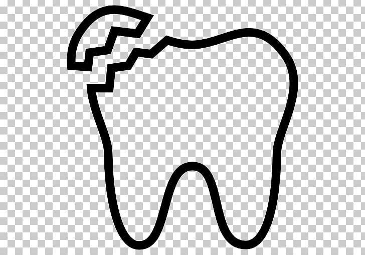 Human Tooth Dentistry Crown PNG, Clipart, Area, Black, Black And White, Cracked Tooth Syndrome, Crown Free PNG Download