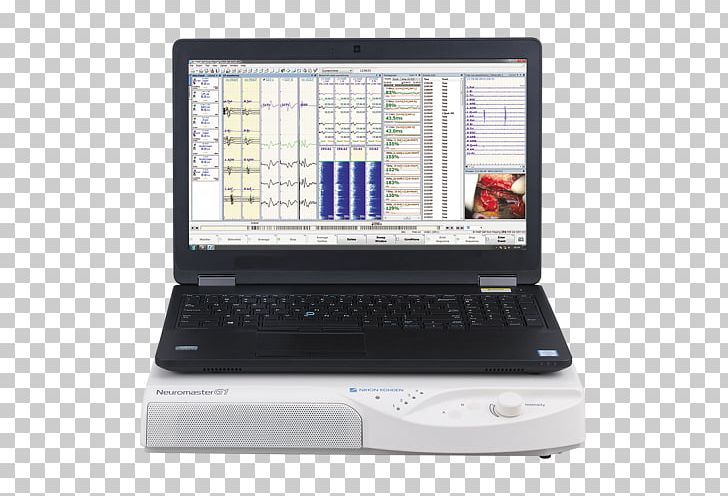 Netbook Laptop Computer Hardware Personal Computer Computer Monitors PNG, Clipart, Cardiology, Computer, Computer Hardware, Computer Monitors, Defibrillation Free PNG Download