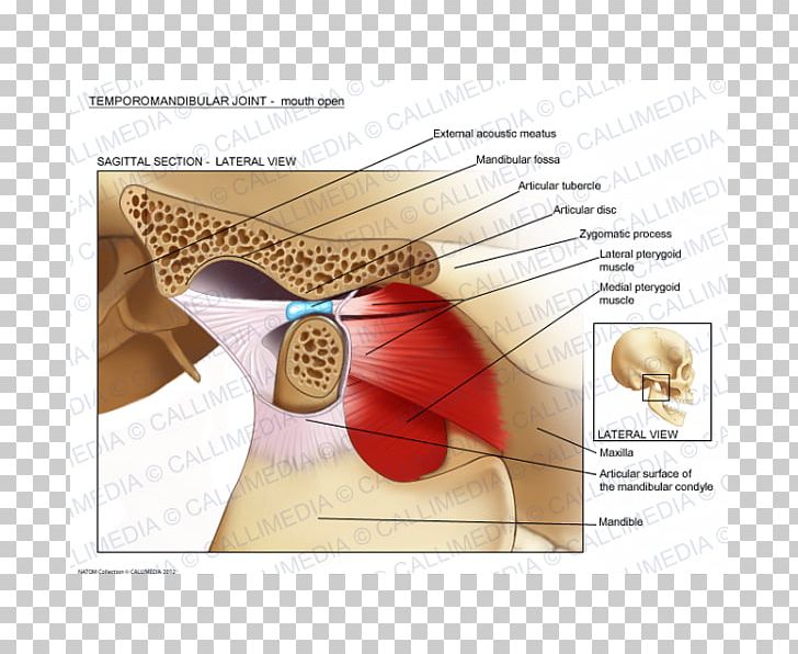 Temporomandibular Joint Dysfunction Anatomy Mandible PNG, Clipart, Anatomy, Ankylosis, Diagram, Ear, Fantasy Free PNG Download