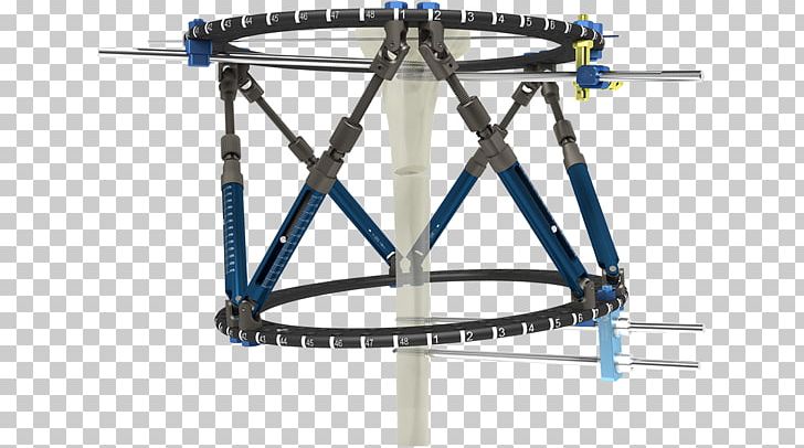 Bicycle Frames Ilizarov Apparatus External Fixation Bicycle Wheels PNG, Clipart, Angle, Bicycle, Bicycle Frame, Bicycle Frames, Bicycle Part Free PNG Download