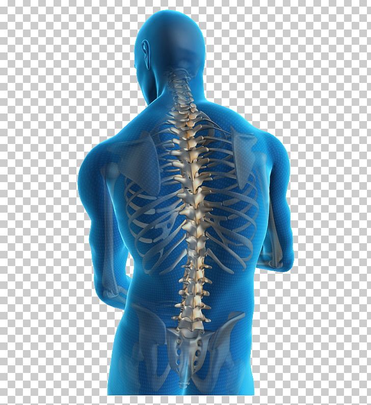 Low Back Pain Neck Pain Back Injury Human Back PNG, Clipart, Arm, Back, Back Pain, Electric Blue, Human Free PNG Download