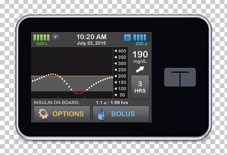 Insulin Pump Tandem Diabetes Care Food And Drug Administration Diabetes Mellitus PNG, Clipart, Animas Corporation, Artificial Pancreas, Basal, Continuous Glucose Monitor, Diabetes Mellitus Free PNG Download