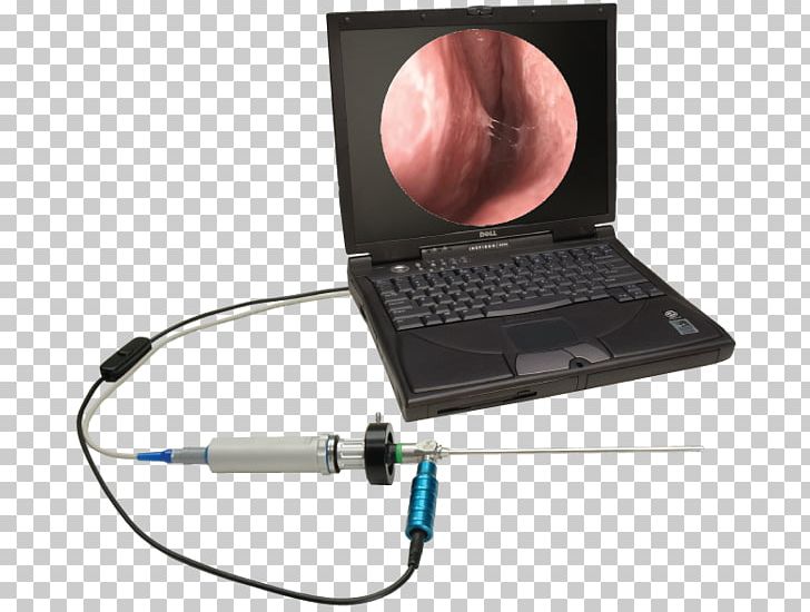 Capsule Endoscopy Otorhinolaryngology Video Cameras Physician PNG, Clipart, Camera, Colposcopy, Electronic Device, Electronics Accessory, Endoscopic Ultrasound Free PNG Download