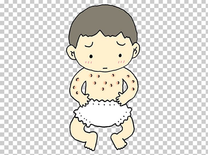 Skin Atopic Dermatitis Allergy Infant No PNG, Clipart, Allergen, Allergies, Allergy, Beauty Skin, Care Free PNG Download