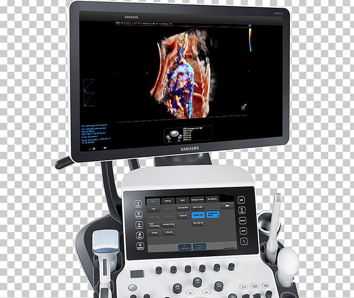 Ultrasonography Ultrasound Obstetrics And Gynaecology Radiology Medical Diagnosis PNG, Clipart, Display Device, Electronics, Family Medicine, Gynaecology, Hardware Free PNG Download