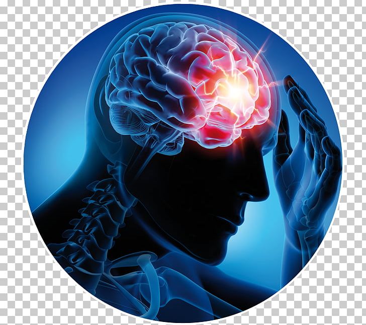 Neurological Disorder Neurology Epilepsy Neurorehabilitation Epileptic Seizure PNG, Clipart, Cure, Disease, Electric Blue, Epileptic Seizure, Head Injury Free PNG Download