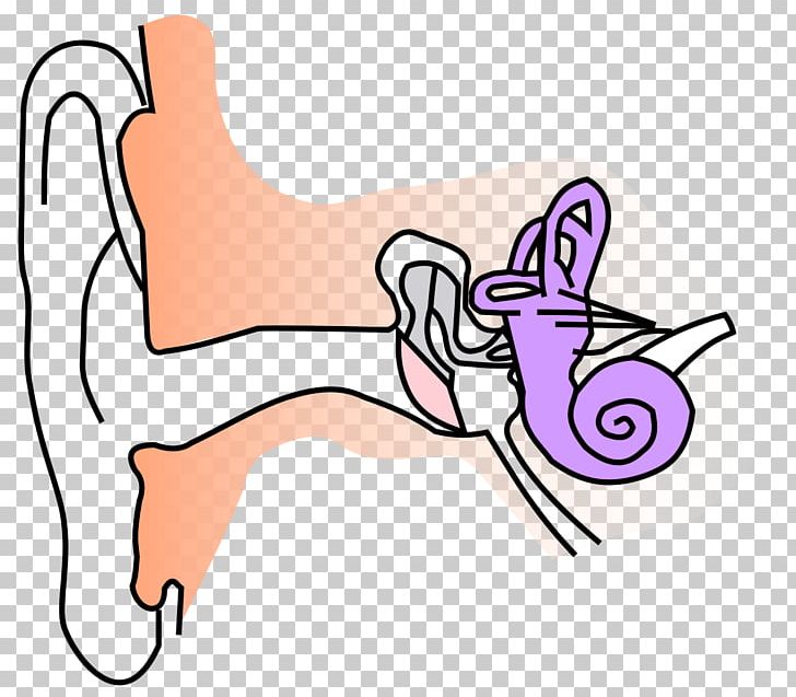 Otitis Externa Ear Anatomy Ear Canal Outer Ear PNG, Clipart, Angle, Area, Arm, Art, Cartoon Free PNG Download