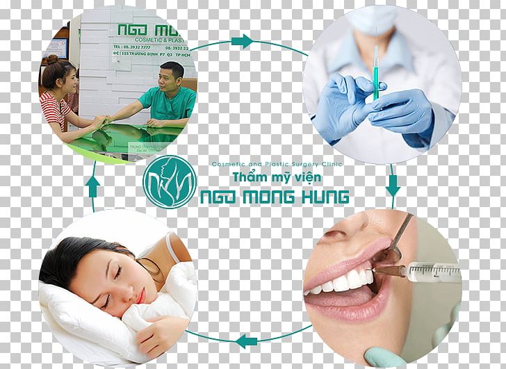 Surgery Beauty Parlour Lip Augmentation Filler Woman PNG, Clipart, Beauty, Beauty Parlour, Complication, Ear, Filler Free PNG Download