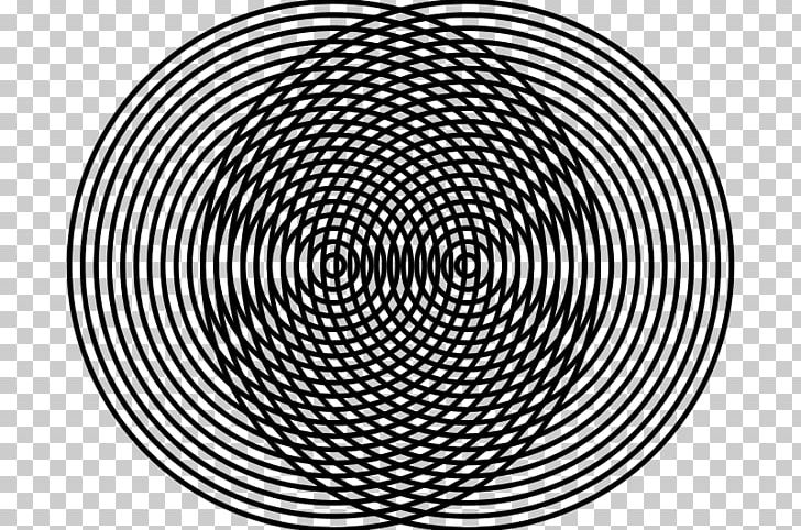 Moiré Pattern Banda Gástrica Virtual Symmetry Circle Pattern PNG, Clipart, Area, Black And White, Circle, Hypnosis, Line Free PNG Download