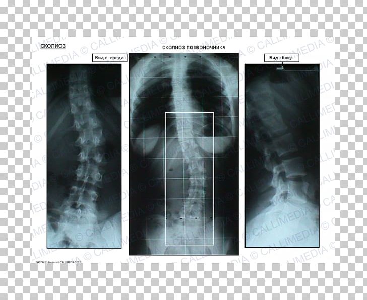 X-ray Radiology Medical Imaging Radiography Stock Photography PNG, Clipart, Jaw, Magnetic Resonance Imaging, Medical, Medical Imaging, Medical Radiography Free PNG Download