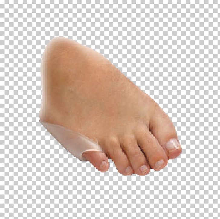 Toe Thumb Nail PNG, Clipart, Bunionectomy, Finger, Foot, Hand, Leg Free PNG Download