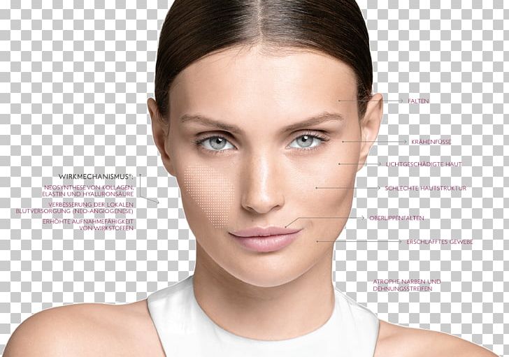 Collagen Induction Therapy Skin Care REVIDERM PNG, Clipart, Beauty, Beauty Parlour, Cheek, Chin, Collagen Induction Therapy Free PNG Download